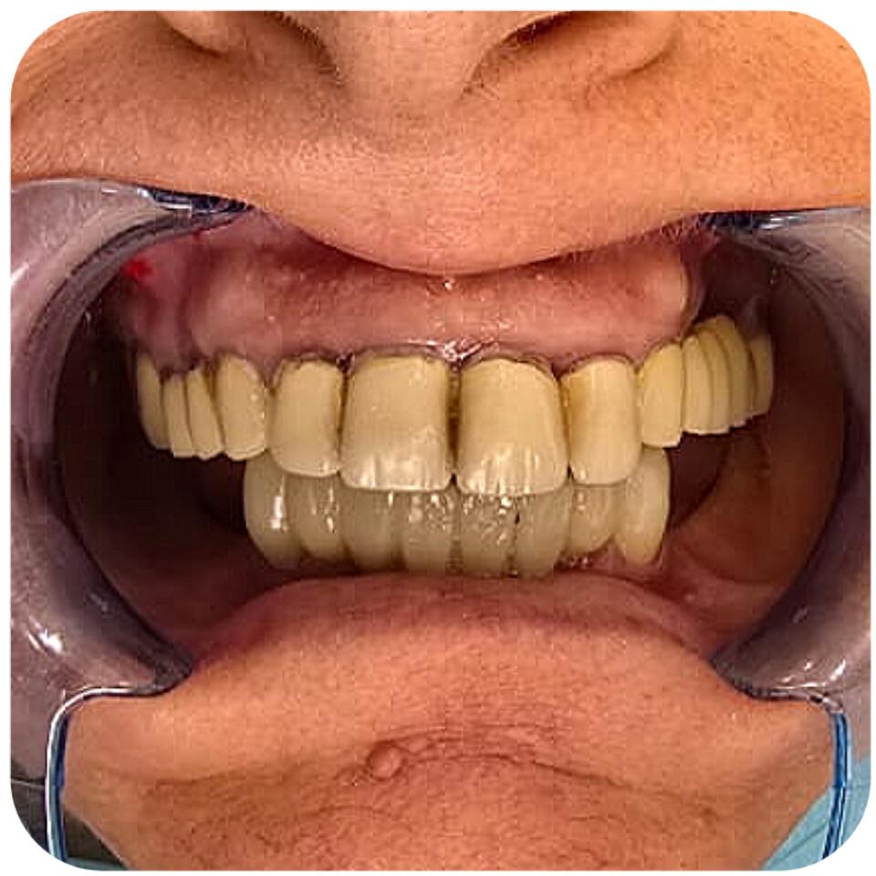 Prima del Trattamento 6